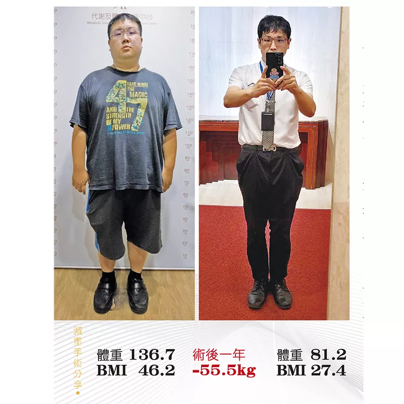 減重手術案例分享 堃