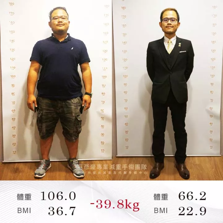 減重手術案例分享 竹