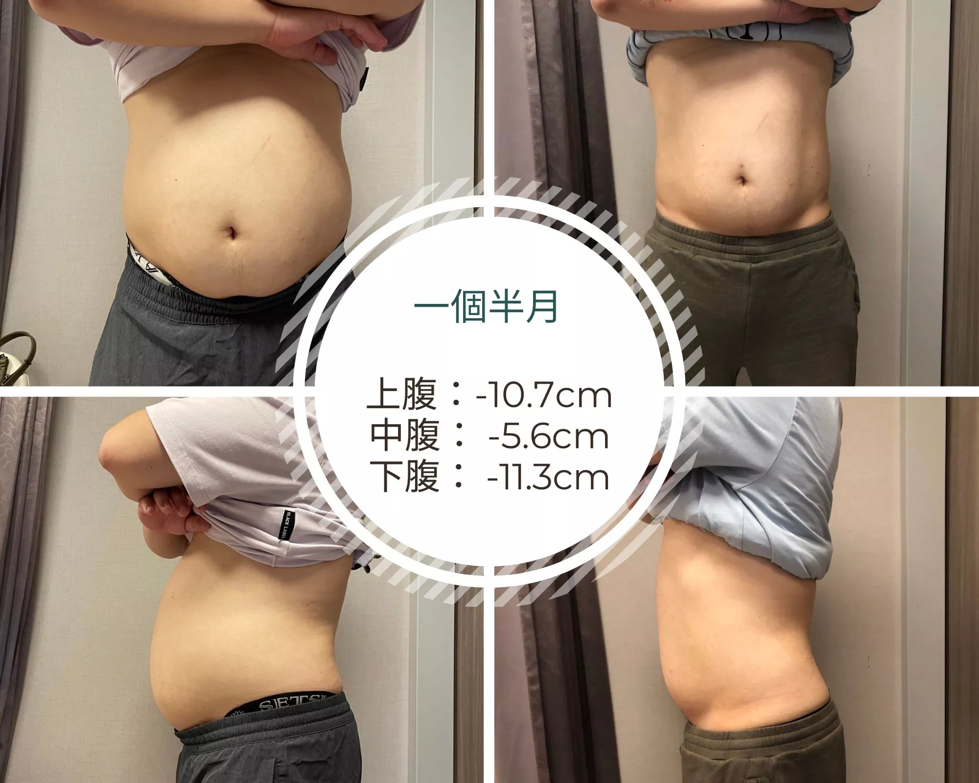 Zerona 光雕減脂超乎預期