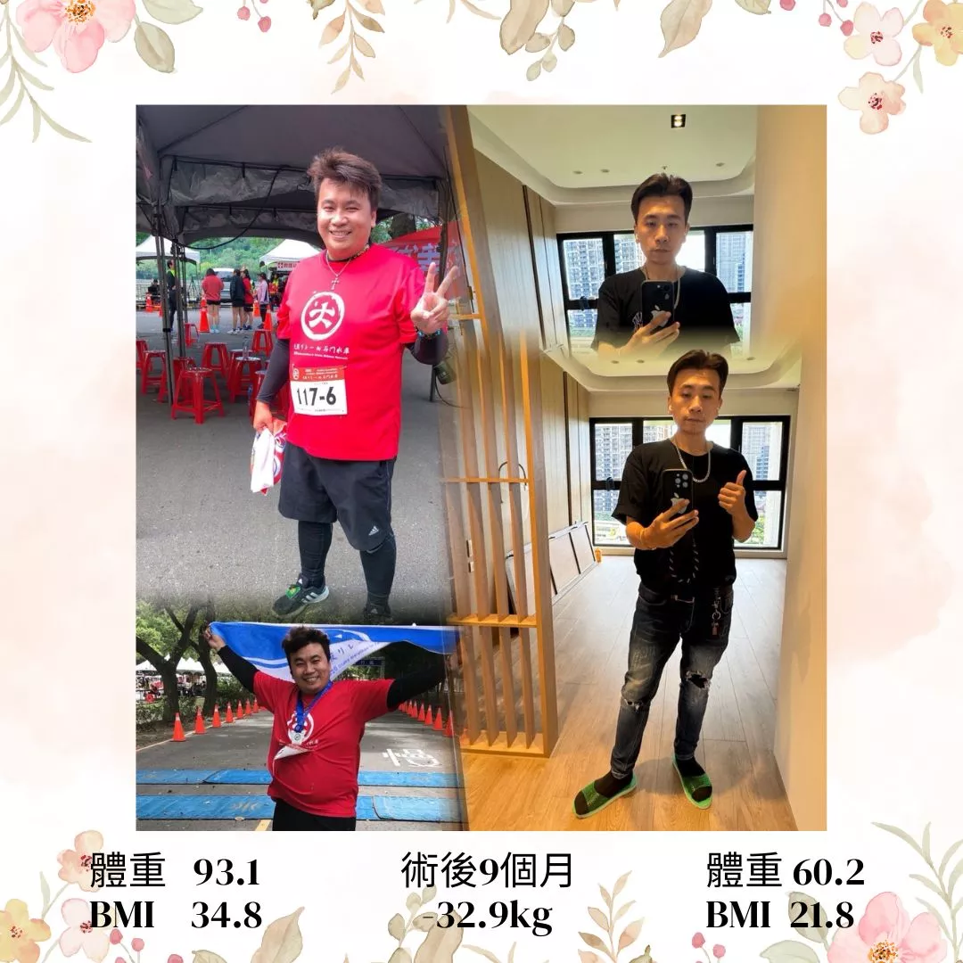 減重手術案例分享 少洋