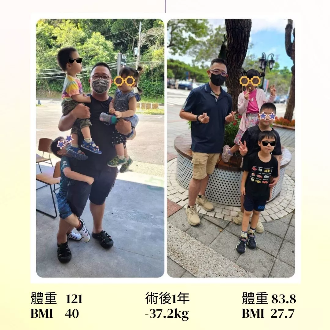 114 減重手術案例分享 俊翰