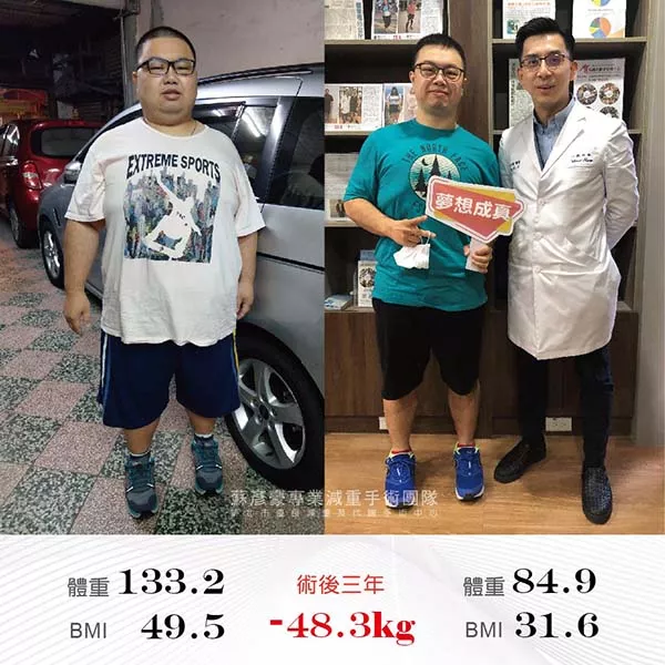 減重手術案例分享 權恆