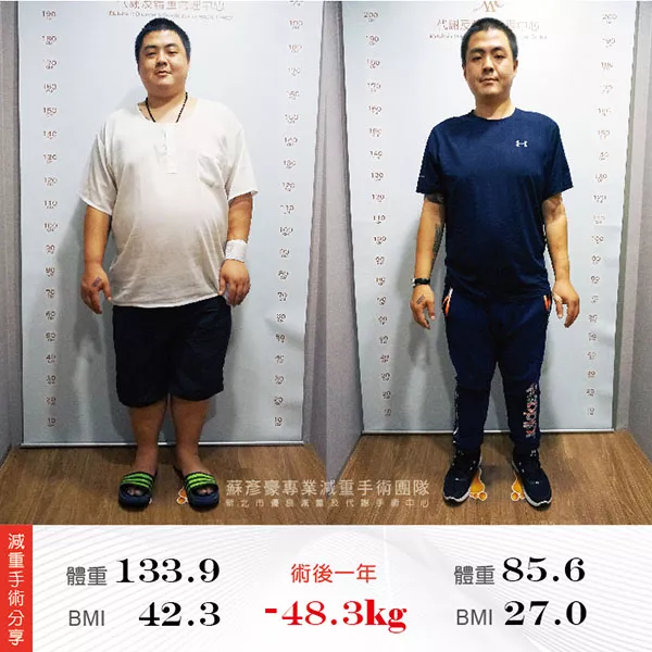減重手術案例分享 博毅