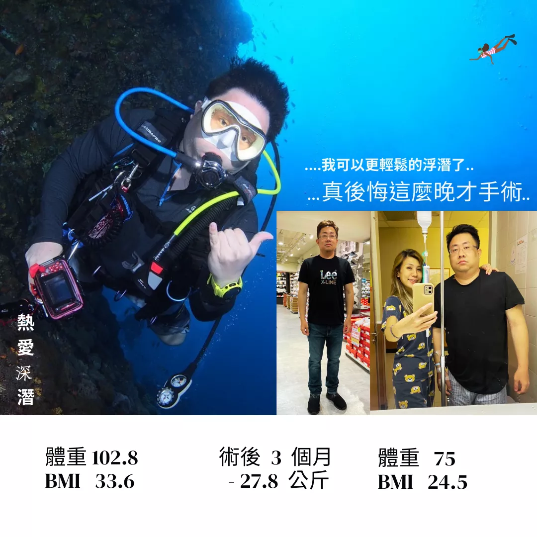 減重手術案例分享 實嘉