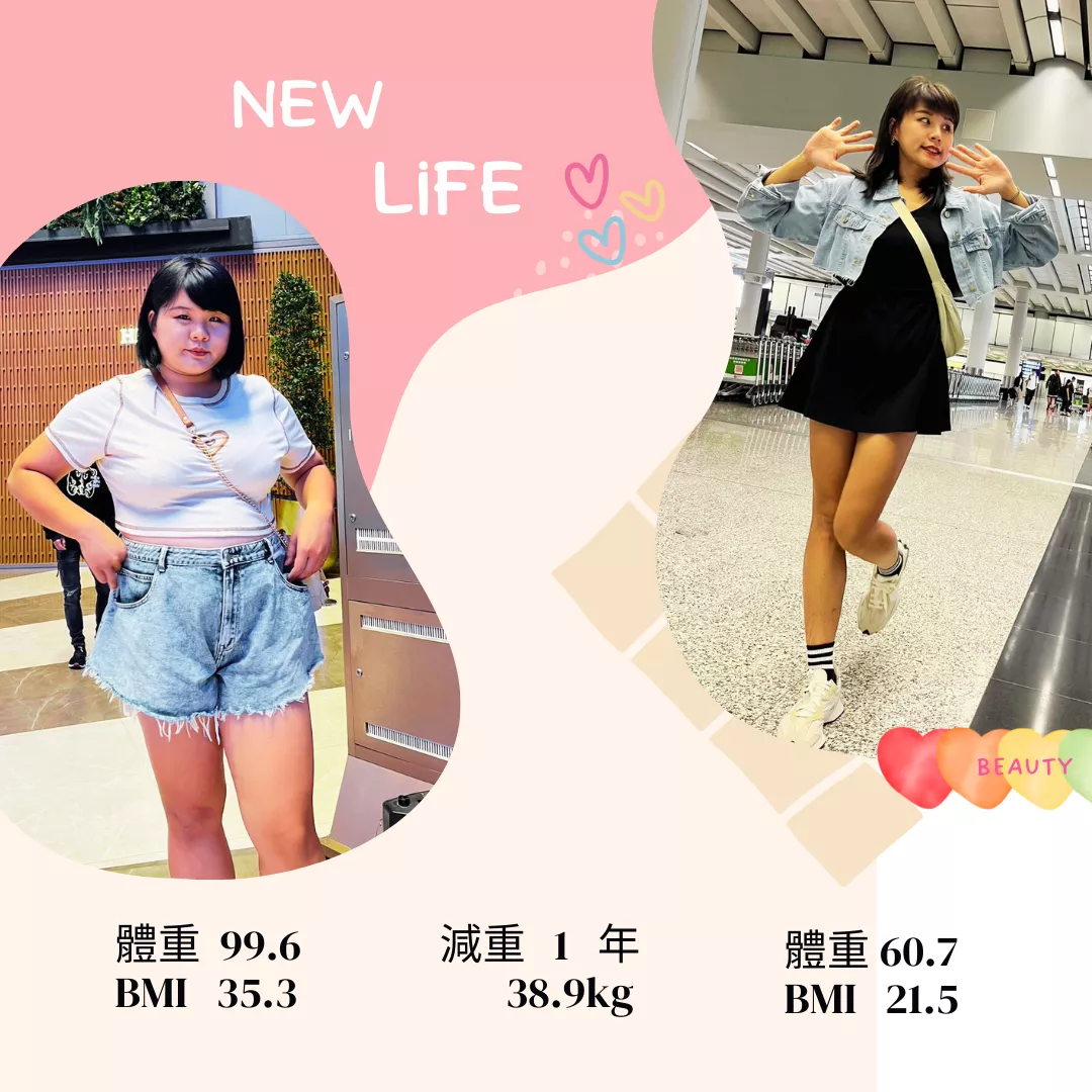 減重手術成功案例 騏筠