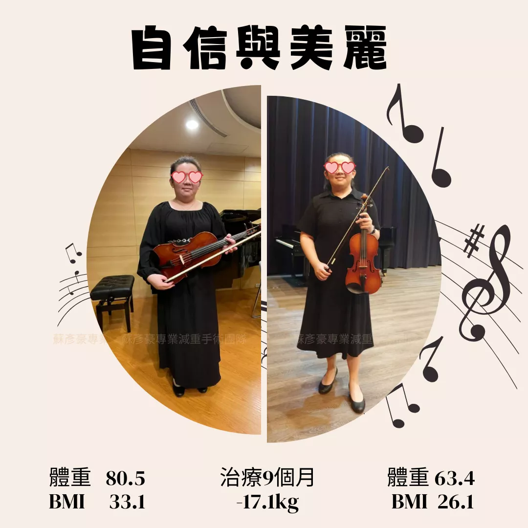 雙和醫院 保守減重 成功案例分享分享 國誠