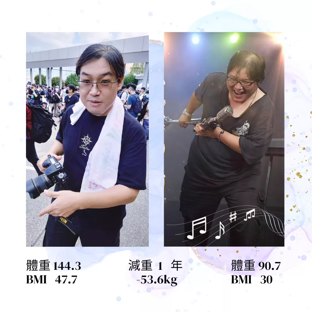 減重手術案例分享 錦成