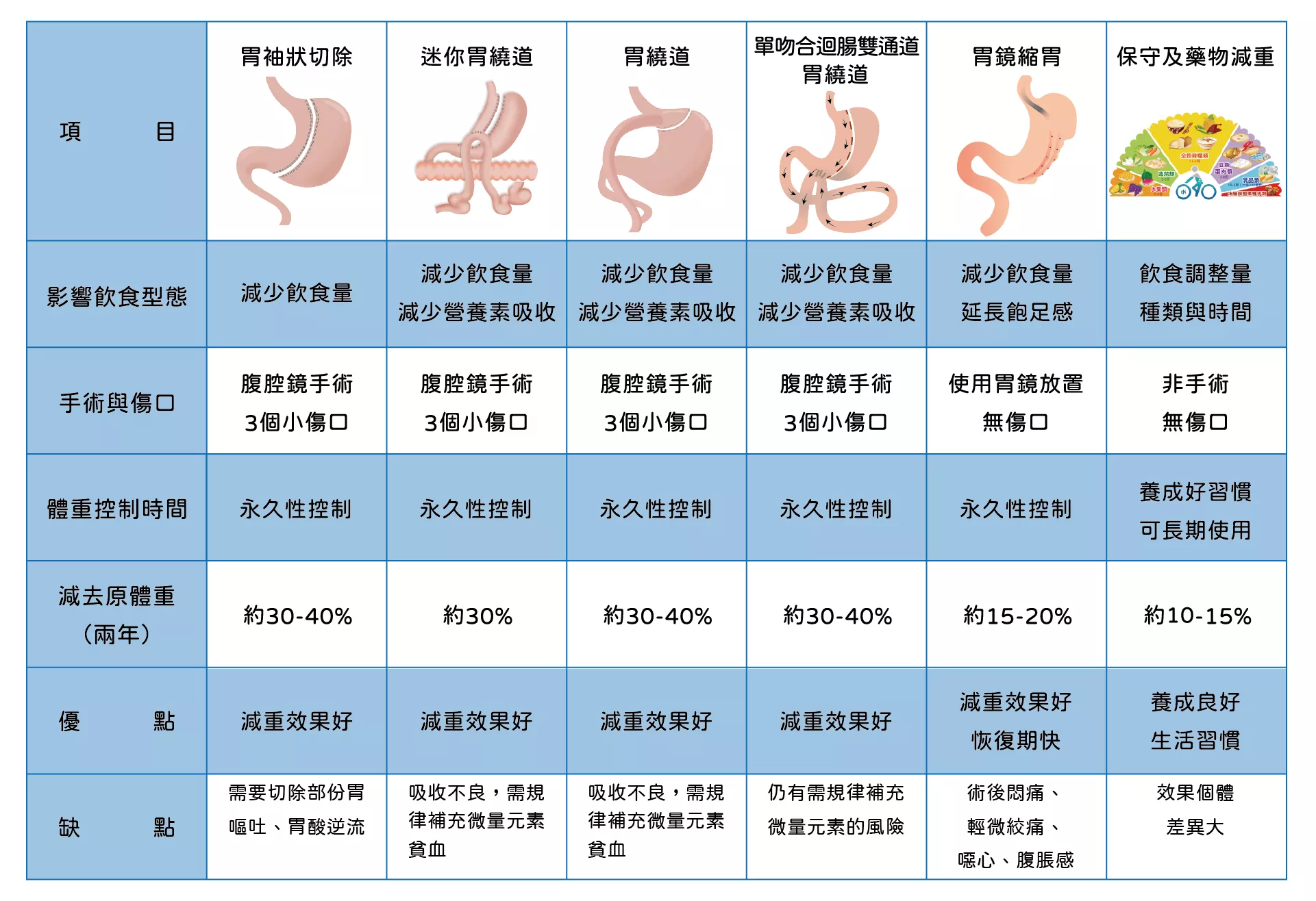 常見減重手術方式比較