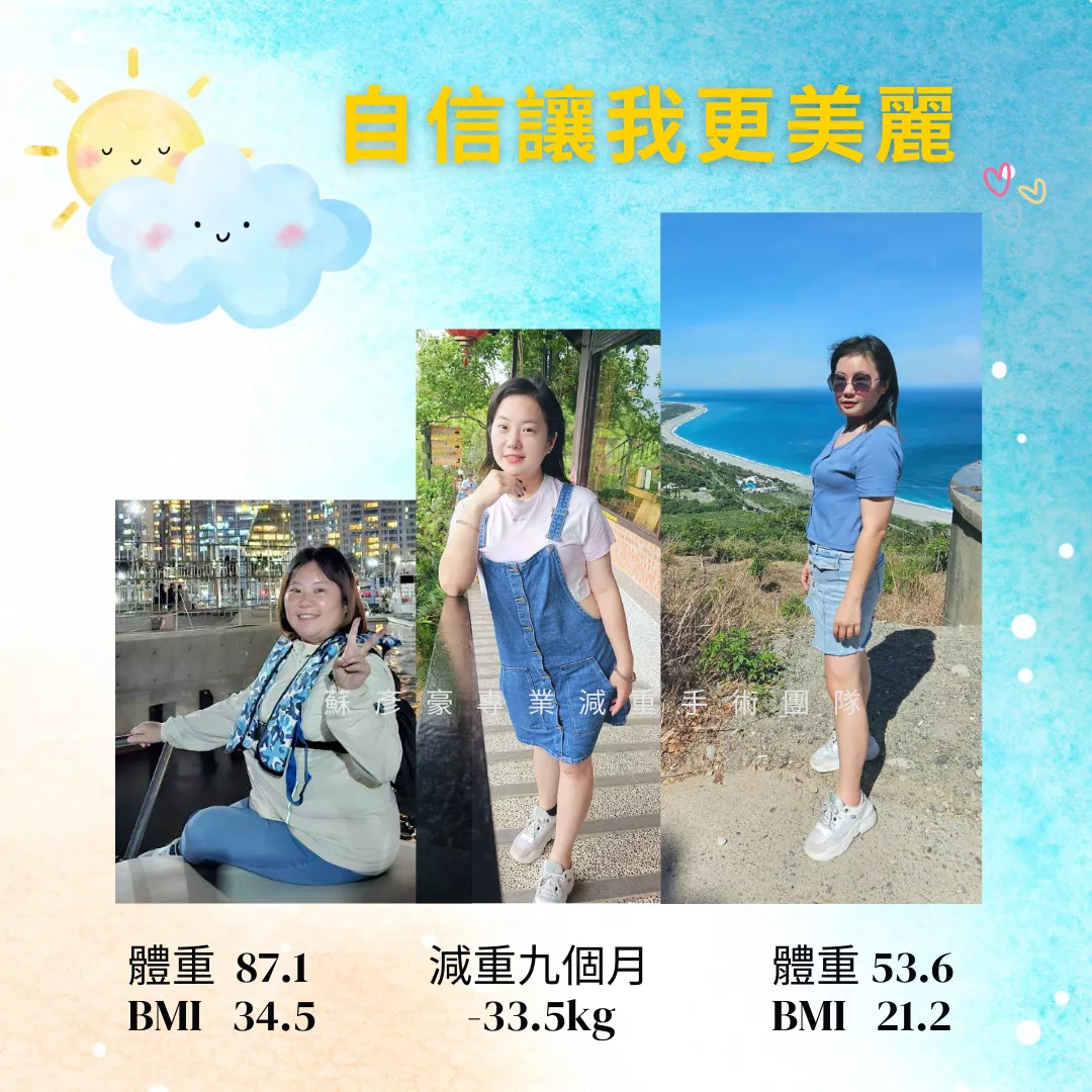 減重手術案例分享 沛璇