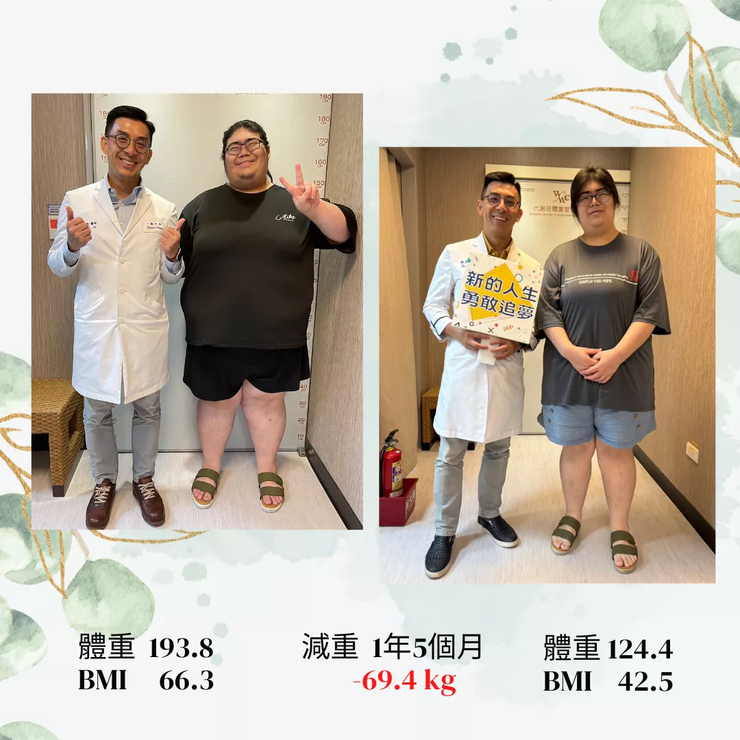 減重手術故事分享02